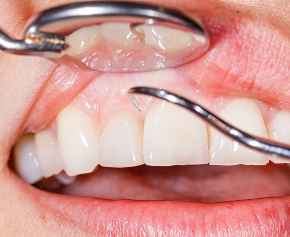 Smiling woman in dentist’s chair